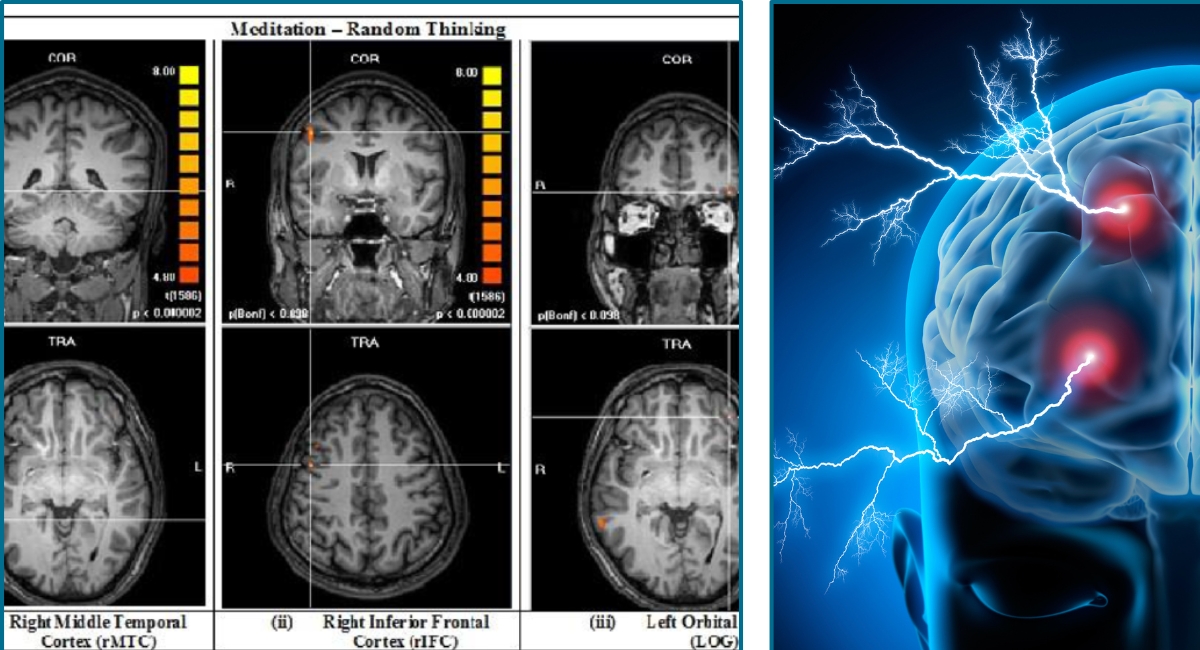 Meditation improves interoceptive awareness through insula activation